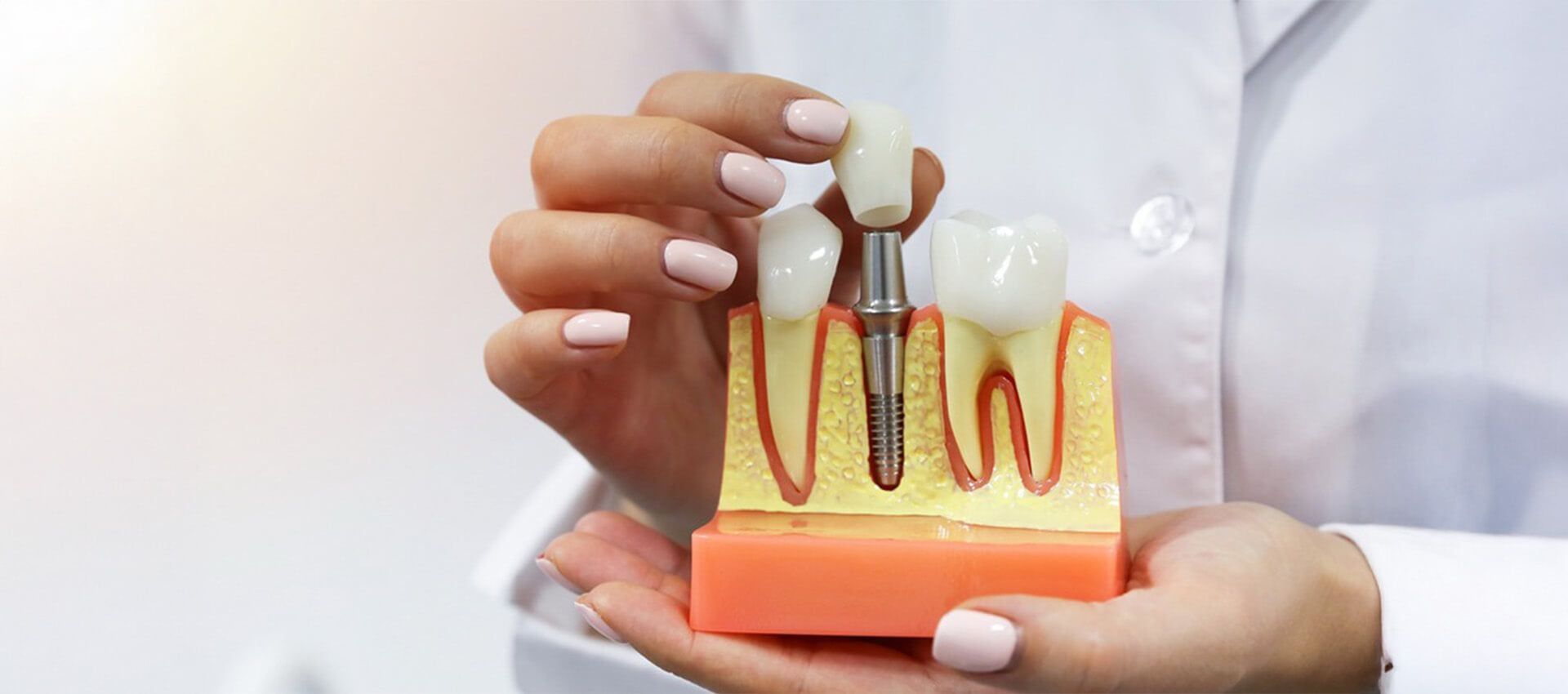 Essential Instruments for Your Dental Implant Kit: A Complete Guide ...