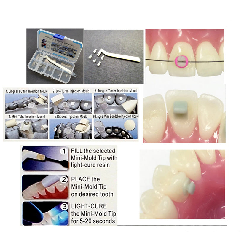 Orthodontic Quick Built Kit for Bracket making, Fix Retainer, Wire Bon