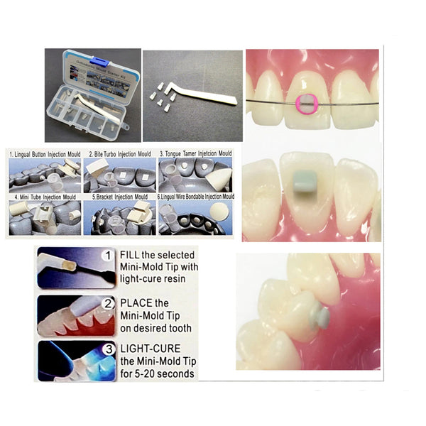 Orthodontic Quick Built Kit for Bracket making, Fix Retainer, Wire Bonding, Lingual buttons, Tongue tamer,