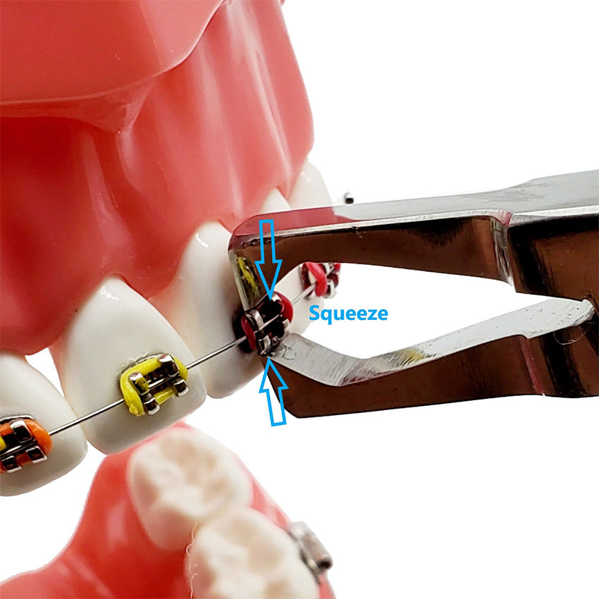 High-Quality Orthodontic Pliers for Braces & Wire Adjustments – Artman ...